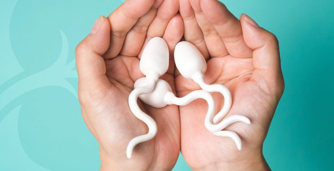 La Varicocele Y Su Posible Impacto En La Infertilidad