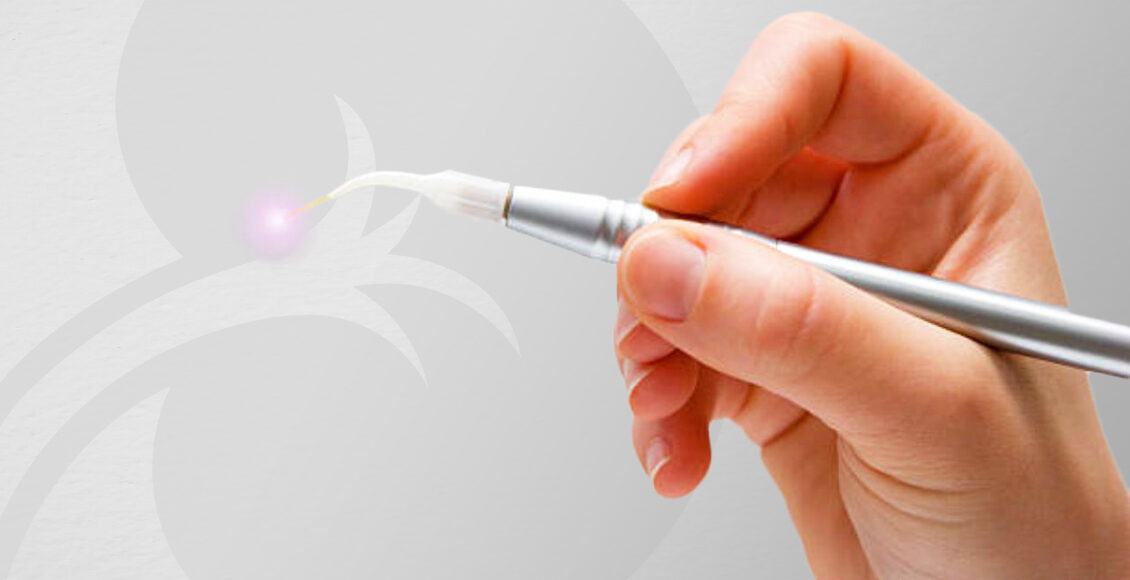 Circuncisión Láser en Tijuana